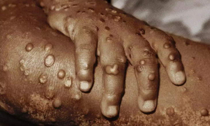 11-vice-campeoes-nacinais-taekwondo-inhambane-dificuldades-mp4-00_01_51_15-still004-2