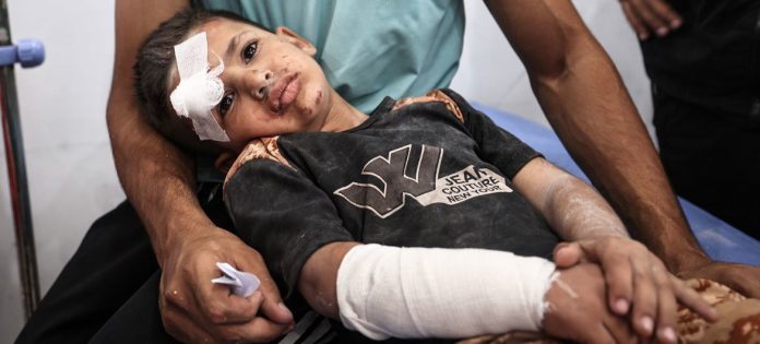 Ayman Abu Hujair, 5, recebe tratamento após um ataque aéreo contra a Escola Al-Hasayneh em Gaza (arquivo, maio de 2025)