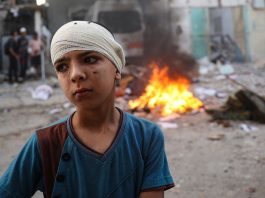 Um menino, com a cabeça enfaixada, em Rafah, no sul da Faixa de Gaza