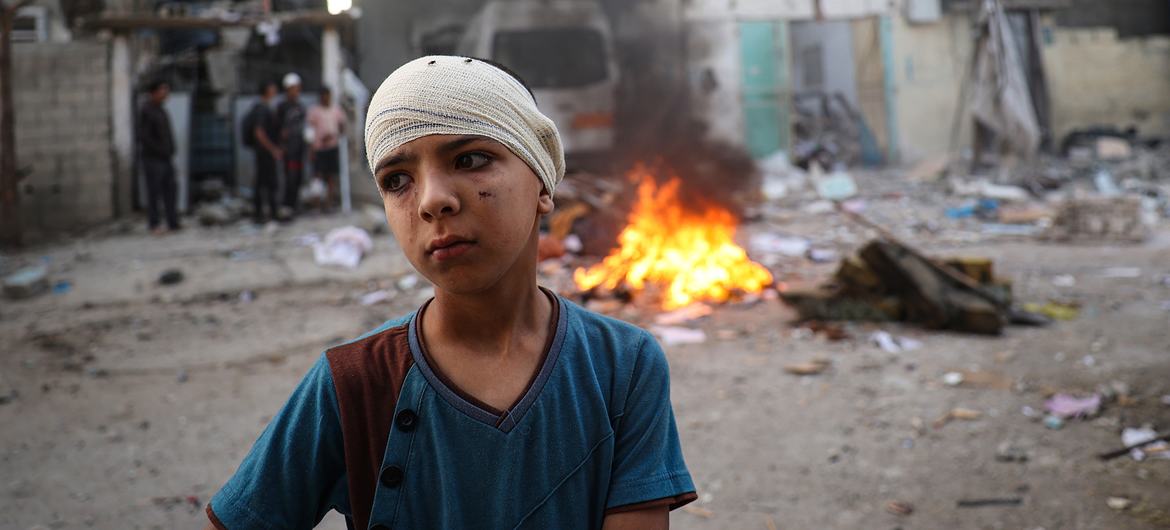 Um menino, com a cabeça enfaixada, em Rafah, no sul da Faixa de Gaza