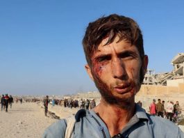 Um jovem de Gaza ferido no rosto ao tentar obter ajuda