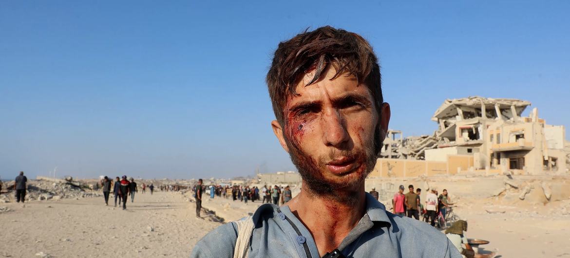 Um jovem de Gaza ferido no rosto ao tentar obter ajuda