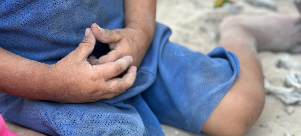 Crianças sofrem com colapso em Gaza