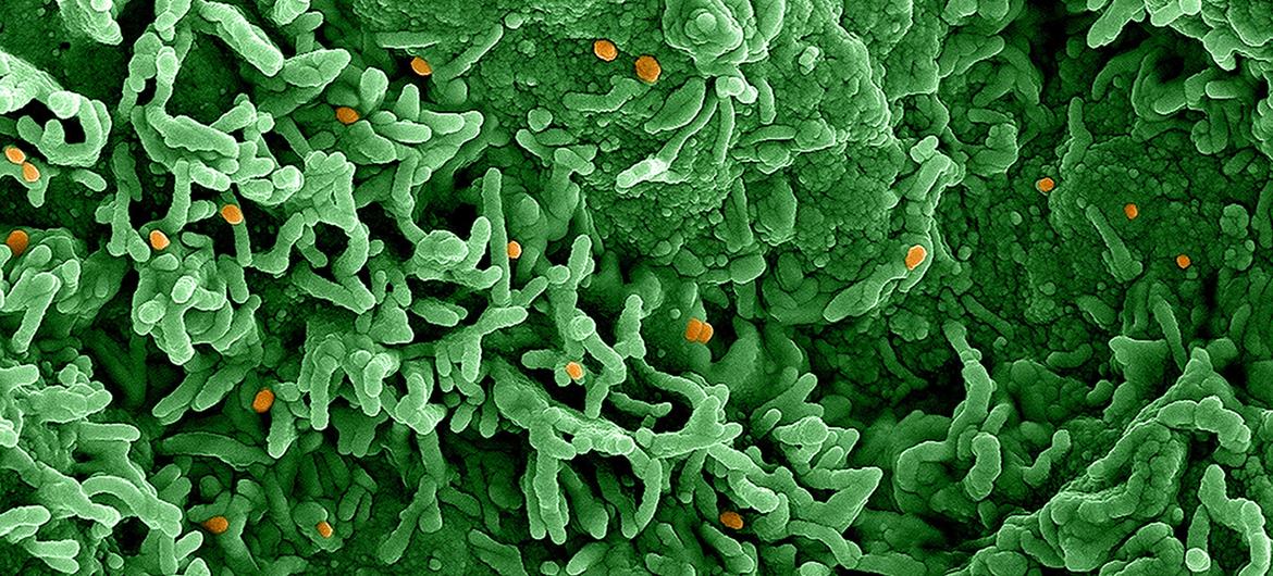 O vírus mpox (laranja) infecta células mostradas em verde O vírus mpox (laranja) infecta células mostradas em verde